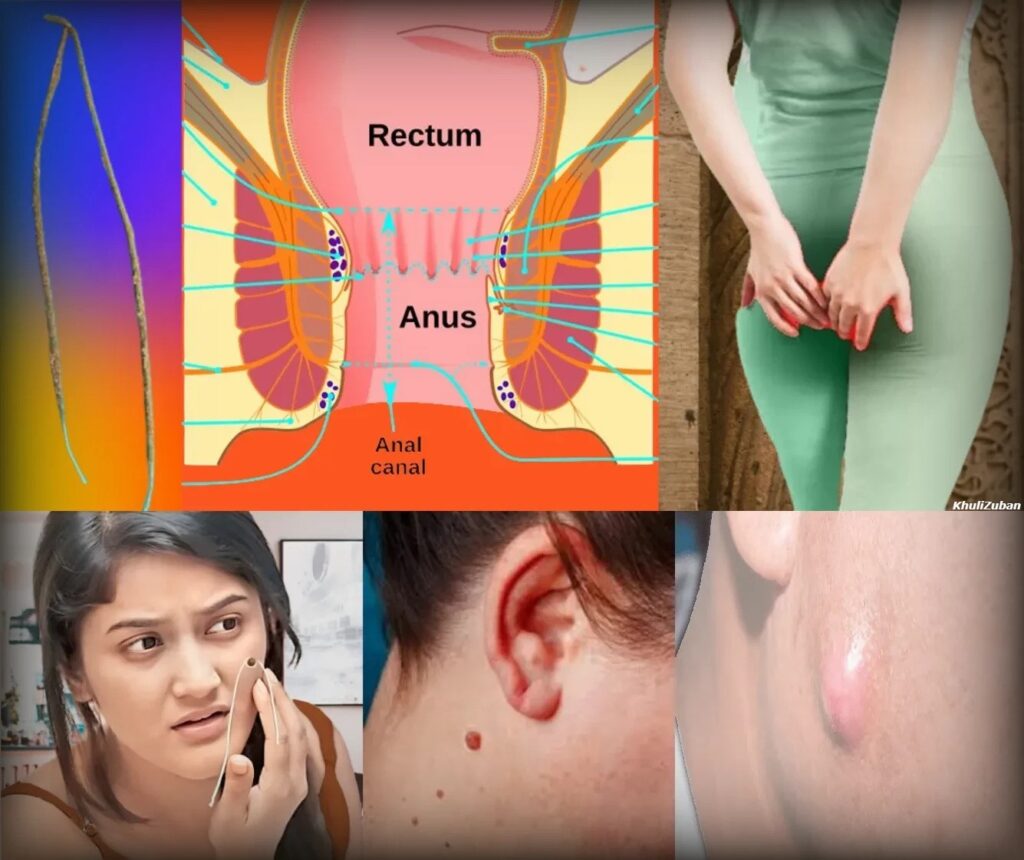 क्षार सूत्र, क्षार सूत्र चिकित्सा, आयुर्वेद में सर्जरी